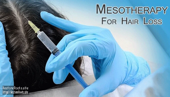 Science Behind Mesotherapy for Hair Restoration