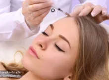 Mesotherapy and Its Impact on Thinning Hair